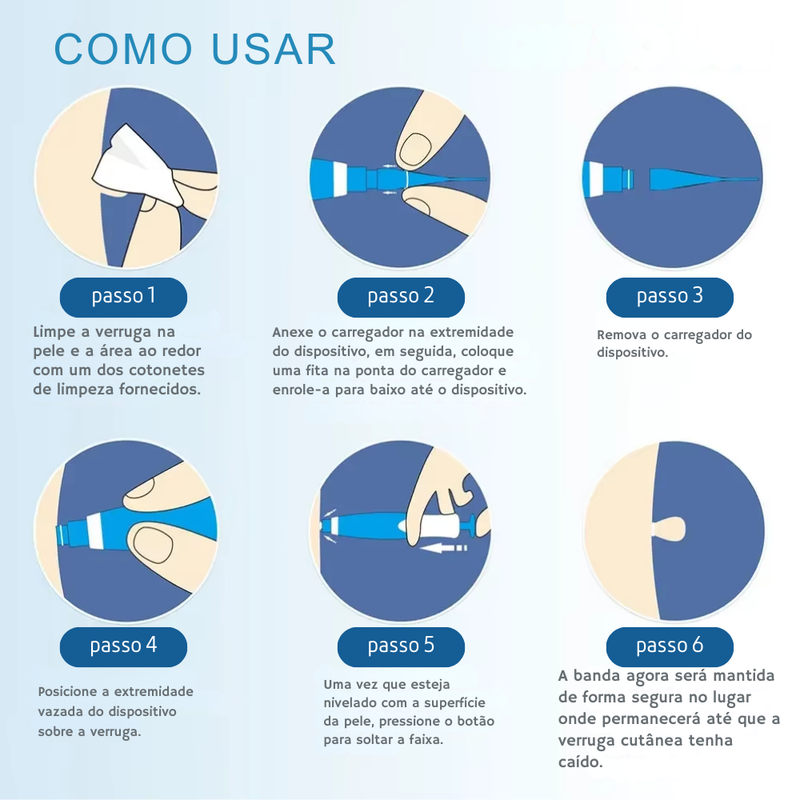 Removedor automático 2 em 1 de Micromarcas e Verrugas da Pele